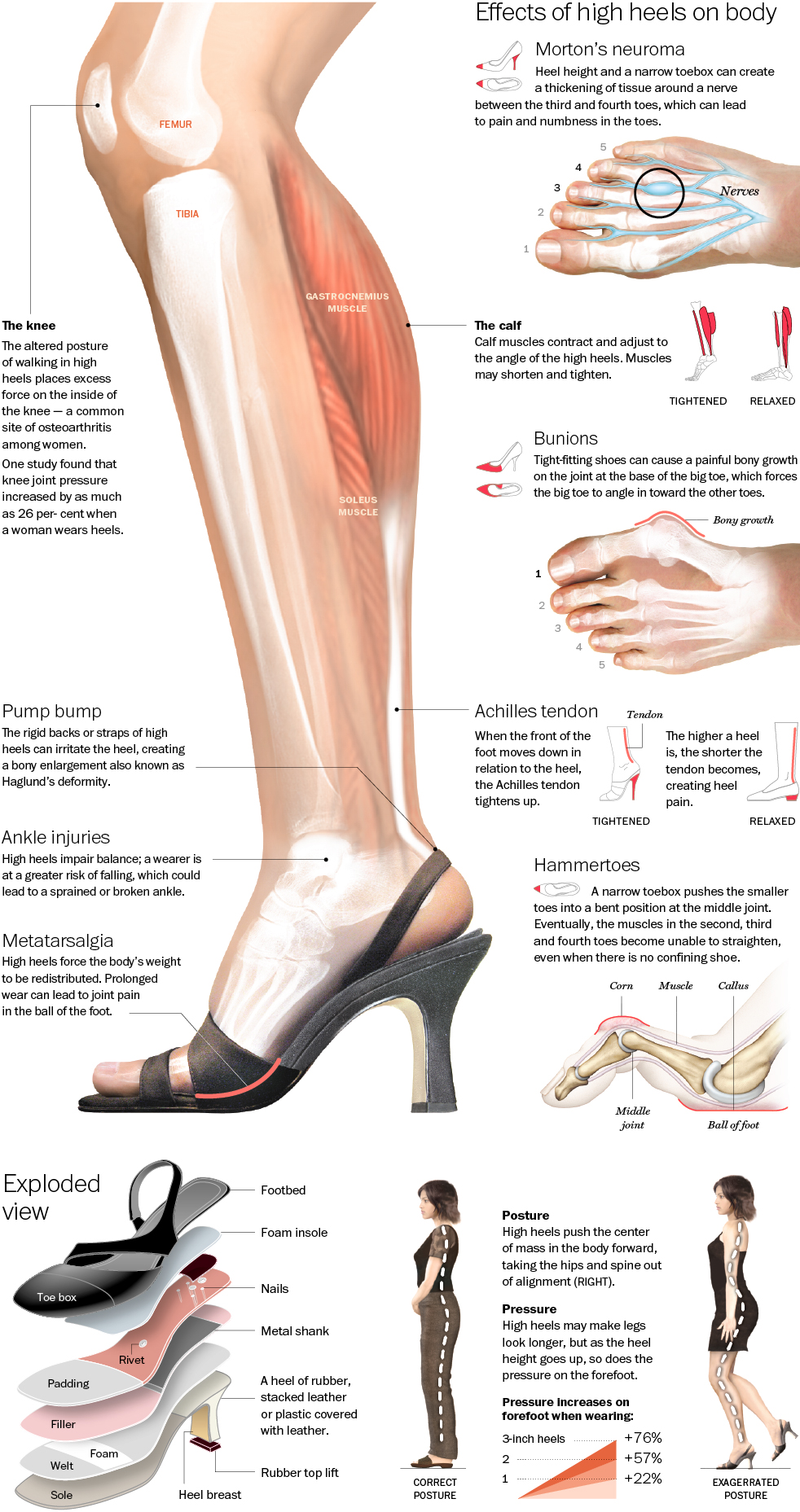 How to Stretch Your Feet If You Wear High Heels