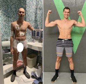 Michael Washburn side-by-side images: during cancer treatment vs. after beating cancer.